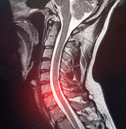 failing bone marrow 