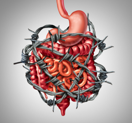 Irritable bowel syndrome in females