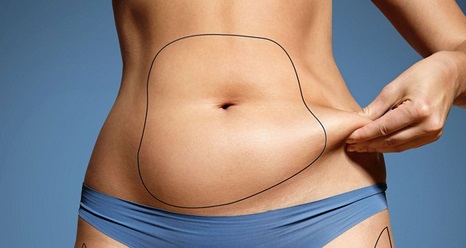 fb cool sculpting stomach ea9e6280cdbe47b7840307b70dee335a