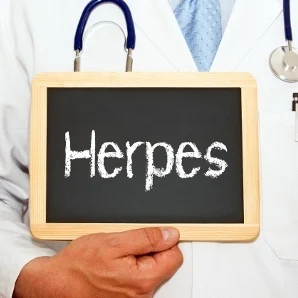 GENITAL HERPES